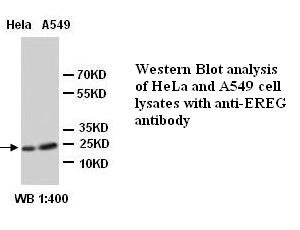 Anti-EREG Antibody