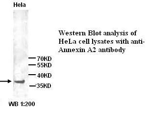 Anti-Annexin A2 Antibody
