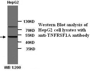 Anti-TNFRSF1A Antibody