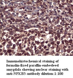 Anti-NFKB3 Antibody