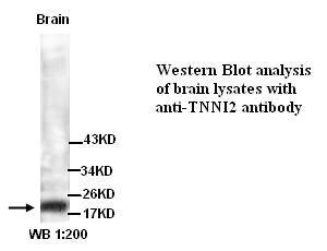 Anti- TNNI2 Antibody