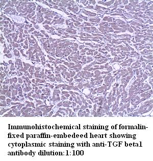 Anti-TGFβ1 Antibody