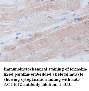 Anti-ACTRT2 Antibody