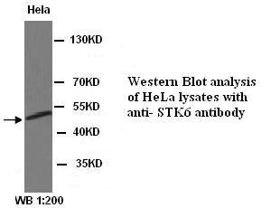 Anti-STK6 Antibody