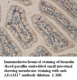 Anti-ADAM7 Antibody