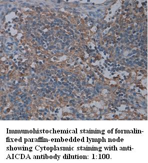 Anti-AICDA Antibody