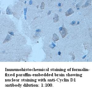 Anti-Cyclin D1 Antibody