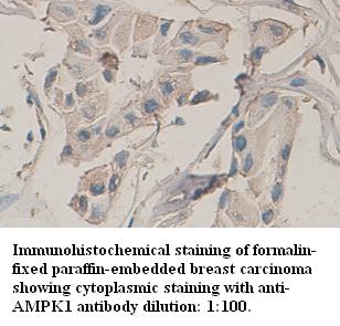 Anti-AMPK1 Antibody