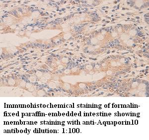 Anti-Aquaporin10 Antibody