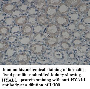 Anti-HYAL1 Antibody