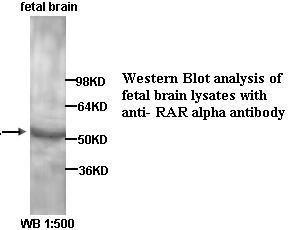 Anti-RAR alpha Antibody