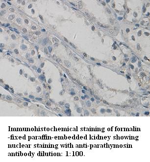 Anti-parathymosin Antibody