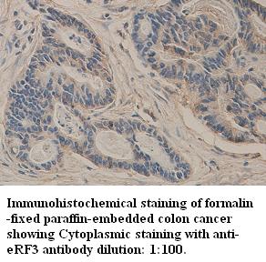 Anti-GSPT1 Antibody