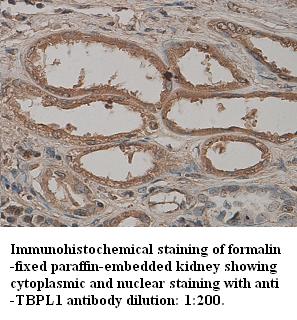 Anti-TBPL1 Antibody