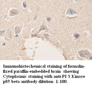 Anti-PI 3 Kinase p85 beta Antibody