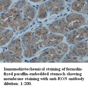 Anti-RON Antibody