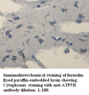 Anti-ATP6B Antibody
