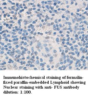 Anti-Fus Antibody