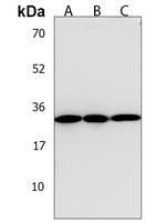 Anti-TPM4 Antibody
