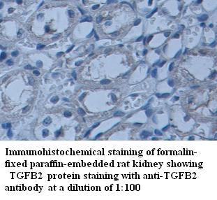 Anti-TGFB2 Antibody
