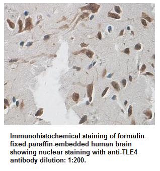 Anti-TLE4 Antibody
