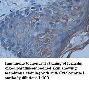 Anti-Cytokeratin Antibody