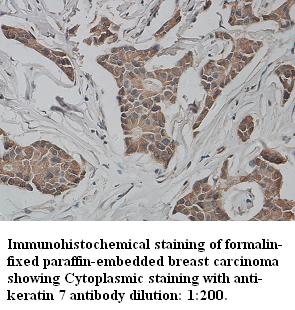 Anti-keratin 7/Cytokeratin 7 Antibody