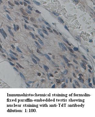 Anti-TdT Antibody