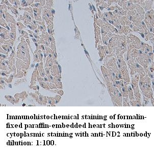 Anti-ND2 Antibody