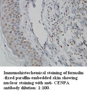 Anti-CENPA Antibody