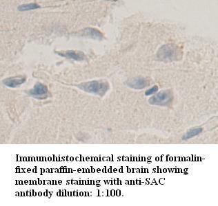 Anti-SAC Antibody