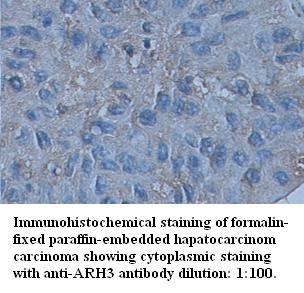 Anti-ARH3 Antibody