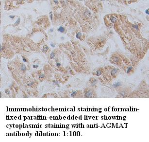 Anti-AGMAT Antibody