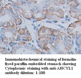 Anti-AHCYL1 Antibody