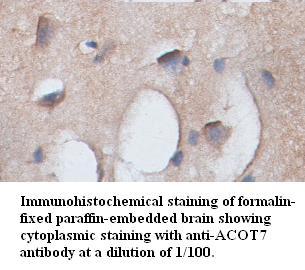 Anti-ACOT7 Antibody