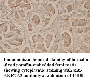 Anti-AKR7A3 Antibody