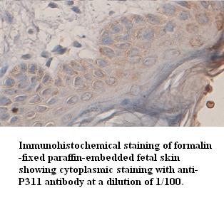 Anti-P311 Antibody
