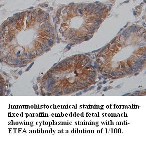 Anti-ETFA Antibody