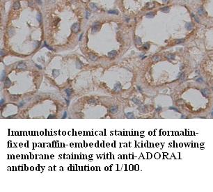 Anti-ADORA1 Antibody