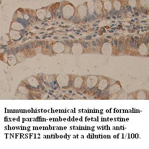 Anti-TNFRSF12 Antibody