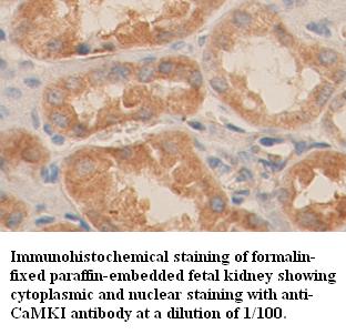 Anti-CaMKI Antibody