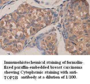 Anti-TOP2B Antibody