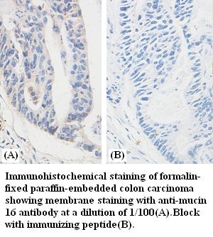Anti-mucin 16 Antibody