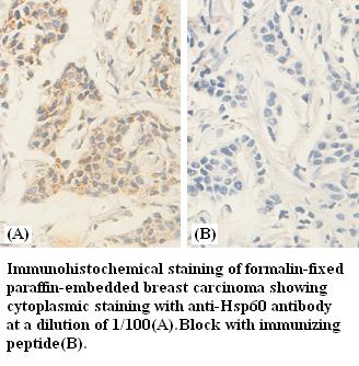 Anti-hsp60 Antibody
