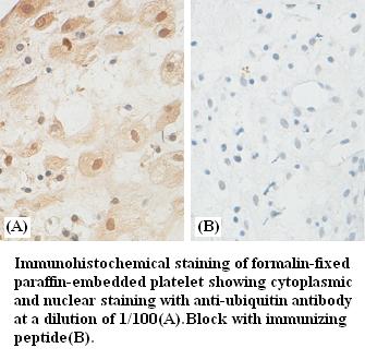 Anti-ubiquitin Antibody