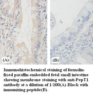 Anti-PepT1 Antibody