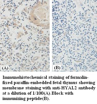Anti-HYAL2 Antibody