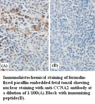 Anti-CCNA2 Antibody