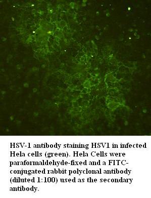 Anti-HSV Antibody
