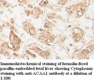 Anti-ACAA1 Antibody